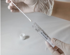 Kemogen Covid-19 qPCR Tanı Kiti
