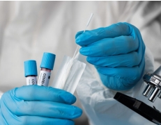 Kemogen Covid-19 qPCR Tanı Kiti