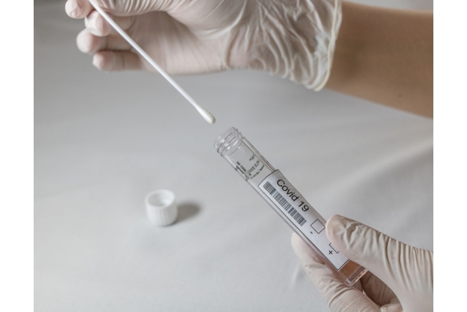 Kemogen Covid-19 qPCR Diagnostic Kit / 1